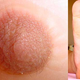 Illustration for article titled Woman Grows Full Size Nipple On Foot